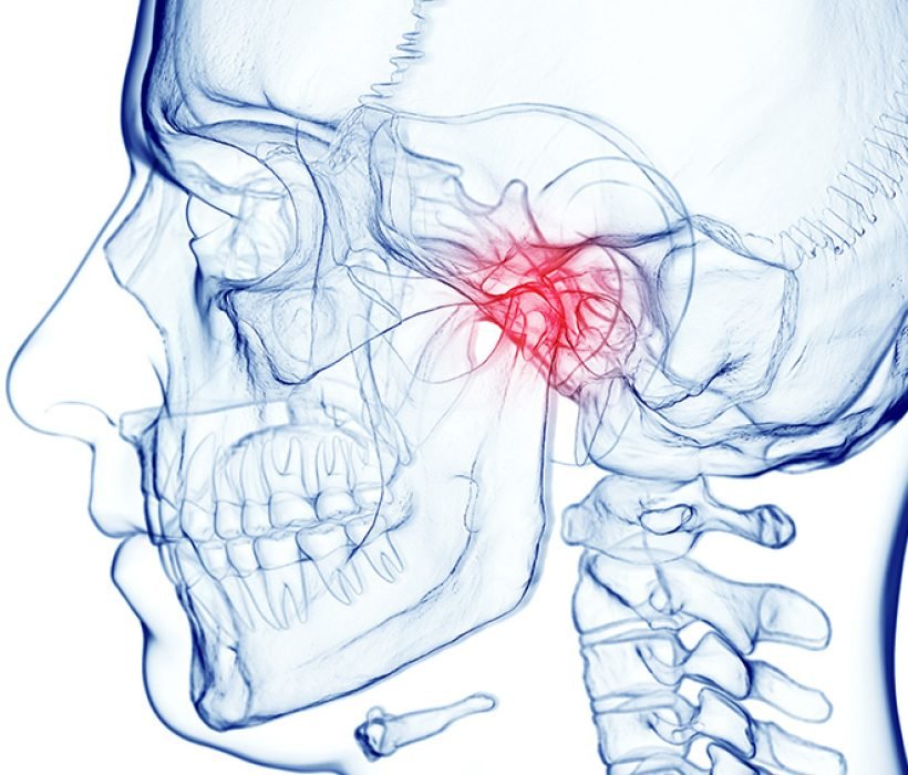 3d rendered medical illustration of male anatomy - skull and cervical spine. jaw pain. plain white background. professional studio lighting.